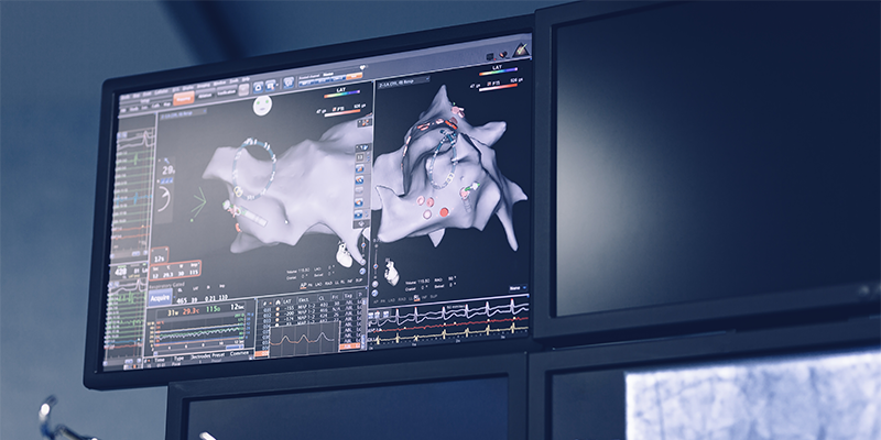 EP lab monitor